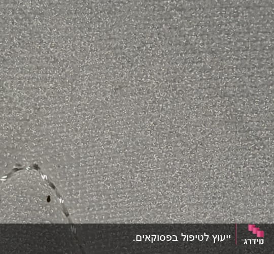 חרק קטן על משטח אפור